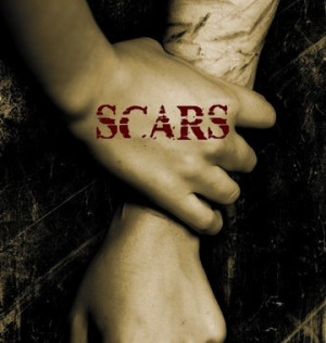 self-injury-scars-from-cutting.jpg