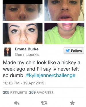 Kylie Jenner Challenge is Taking Over the Net & It’s GROSS! (VIDEO)