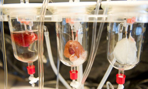 First: Organs Tailor-Made With Body’s Own Cells – New York Times ...