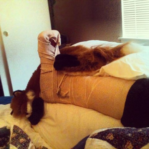 Related Pictures funny broken ankle