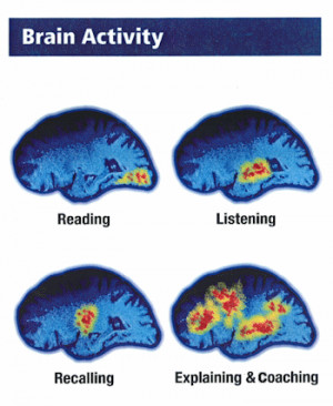 Brain Activity image showing artists rendition based on PET brain ...