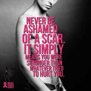 Never Be Ashamed Of A Scar, It Simply Means You Were Stronger Then ...