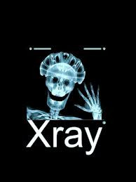 funny+x+ray+images+(2) Funny x ray images, Funny x ray, Pictures of x ...