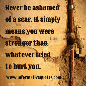 Never be ashamed of your Scar