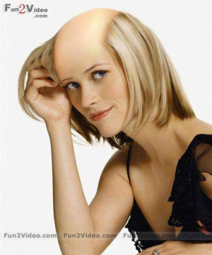 bald-girl-celebrity (15)