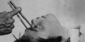 The 10 Most Insane Medical Practices in History