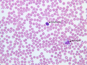 Human Blood Smear Under Microscope