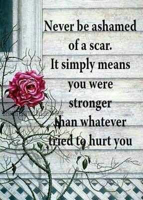 Wear your scars, internal and external, with pride. Something I plan ...