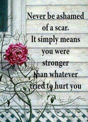 Sayings. scars heal