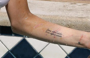 Lindsay Lohan Still Cuts Herself (Pics)