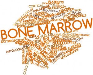 Four Things to Ask Your Doctor About Bone Marrow Transplants