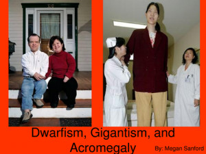 List of People with Dwarfism