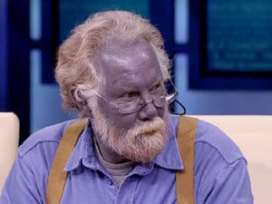 ... was shocked to learn a person actually can have naturally blue skin