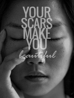 your-scars-make-you-beautiful-jinna-yang-inspirational-quote.jpg