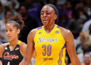 Candace Parker le abre la ceja a una compañera sin querer