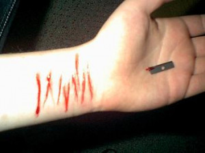 Do you cut your wrist when you are stressedout or depressed?