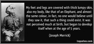 ... began to develop itself when at the age of 5 years. - Joseph Merrick