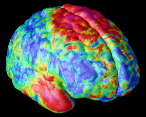 Mapping Brain Tissue Loss in Adolescents with Schizophrenia.