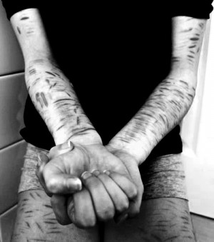 Morbid enough? My case of self harm.