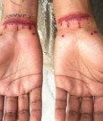 Kid Cudi Slit Wrist Tattoo