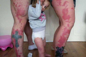 Parents Get Tattoos to Match Daughter's Unique Birthmark