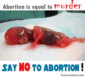Abortion is equals to murder... Say no to abortion !!