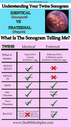 Twin Ultrasound Chart Explained- A great pin for parents expecting # ...