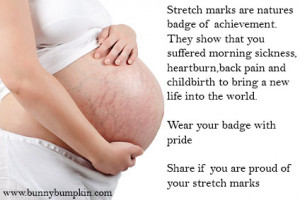 poems about stretch marks