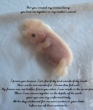 Photographs of miscarried babies show the humanity of the unborn