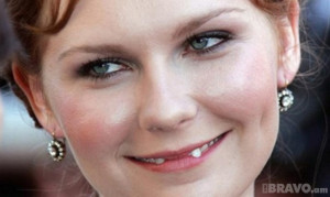 Crooked teeth- attractive or not? Adult Braces?