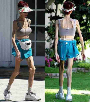 Images, Pics, Pictures and Photos of Anorexia