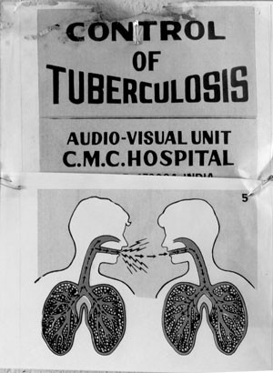 quotes tuberculosis