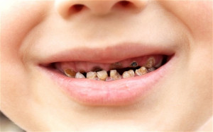 ... to brush teeth at school in a battle against tooth decay Photo: Alamy