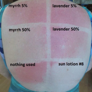 Are you using a chemical based sunscreen?