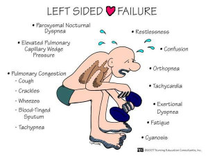 Left Sided Heart Failure Symptoms