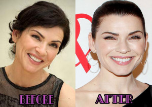 Julianna Margulies Before and After