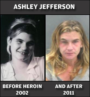 ashley jefferson before heroin and after