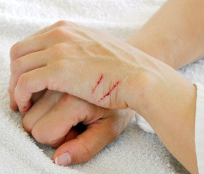 self injury self harm self mutilation can be defined as