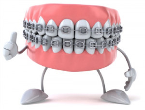 Metal Braces on Teeth :: HoosierHomemade.com