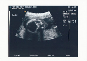Boy Ultrasound Pics