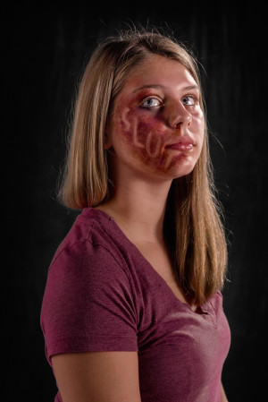 What if verbal abuse left the same scars as physical abuse? Would it ...