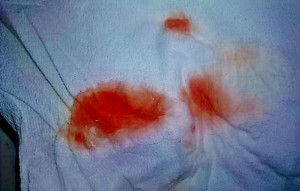 implantation bleeding how to identify implantation bleeding color