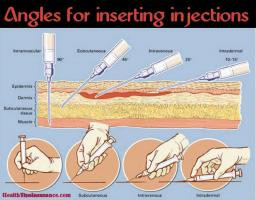Different Angles For Insertion Of Injection