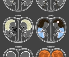 Lorainne (UnderMyRoof) on We Heart It