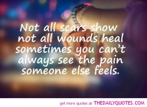 not-all-scars-show-life-life-quotes-sayings-pictures.jpg