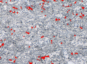 Area Percentage Porosity ASTM E2109; QSLP 03