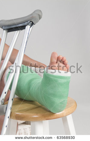 Broken ankle Stock Photos, Illustrations, and Vector Art