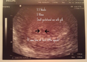 Displaying 19> Images For - Miscarriage At 8 Weeks Quotes...