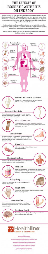 The Effects of Psoriatic Arthritis on the Body: Body Psoriaticarthr ...