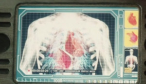 Binary vascular system